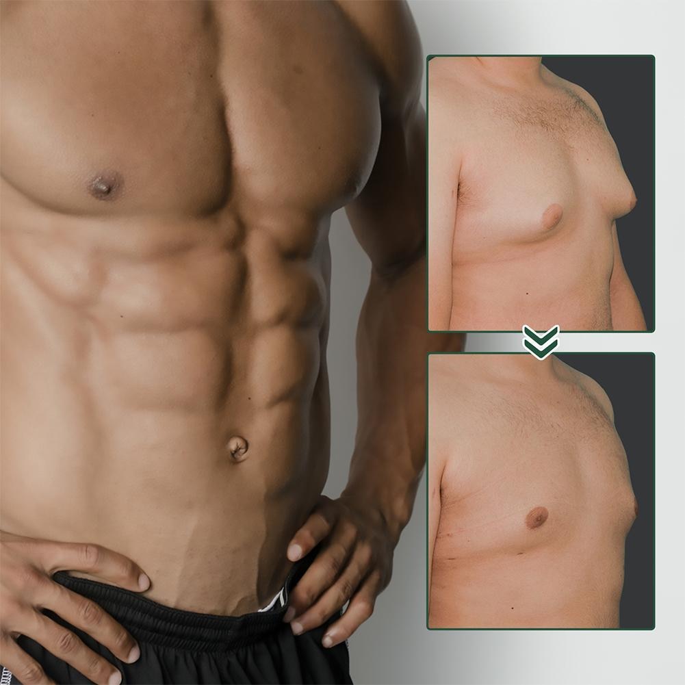 Gynecomastia Tightening Ginger Cream Snapitonline