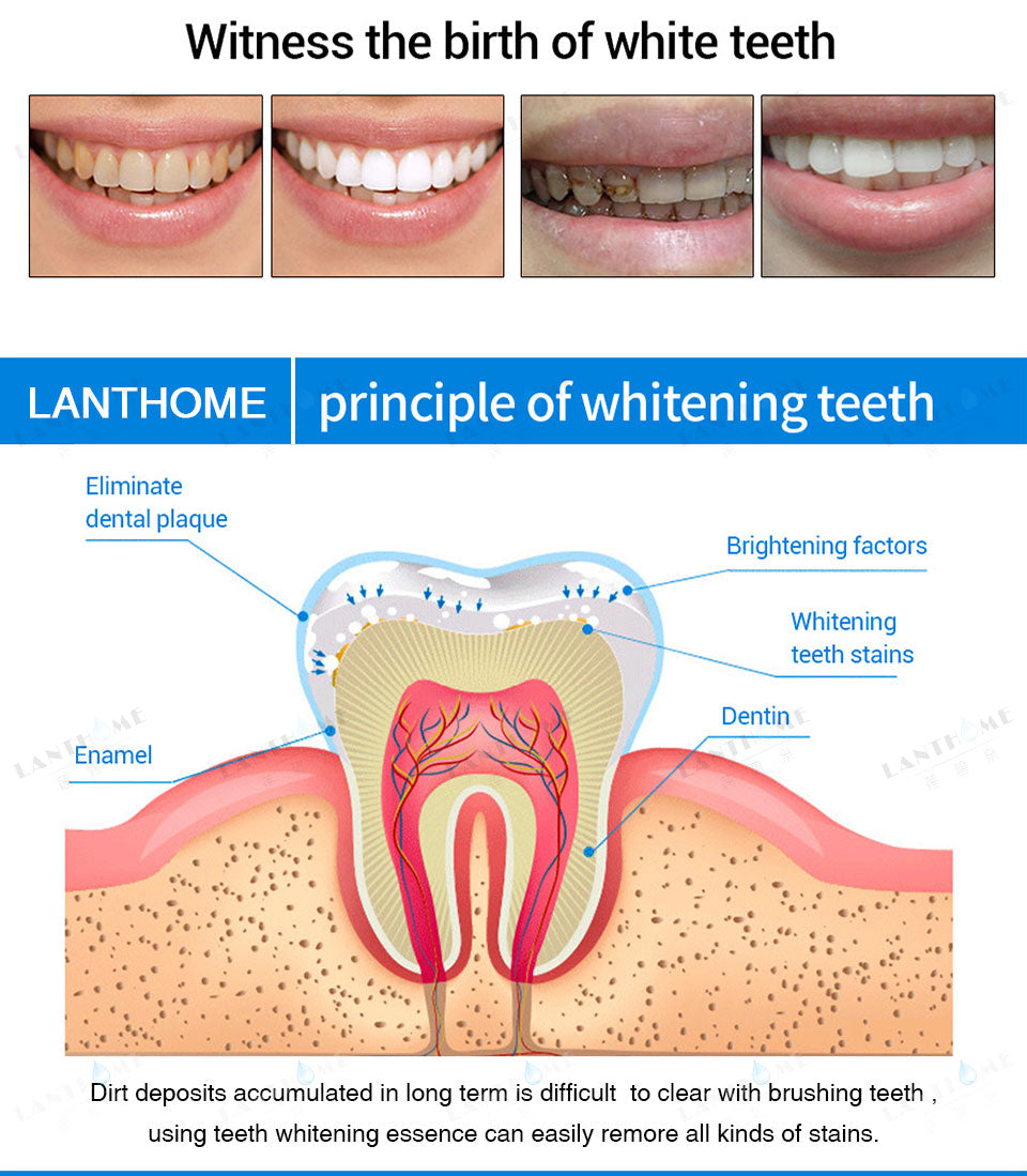 Teeth Whitening Pens - Snapitonline