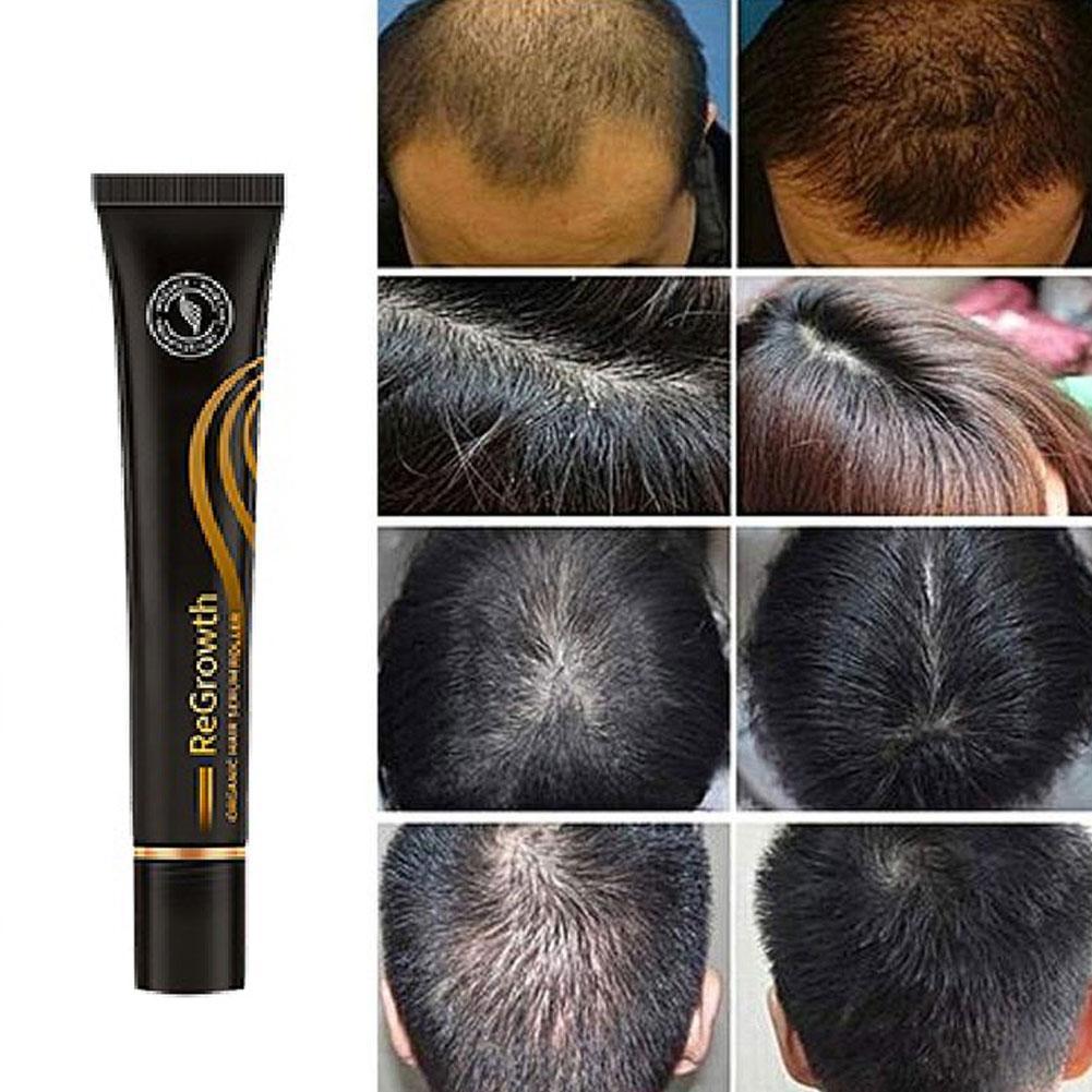 Organic Hair Serum Roller - Snapitonline