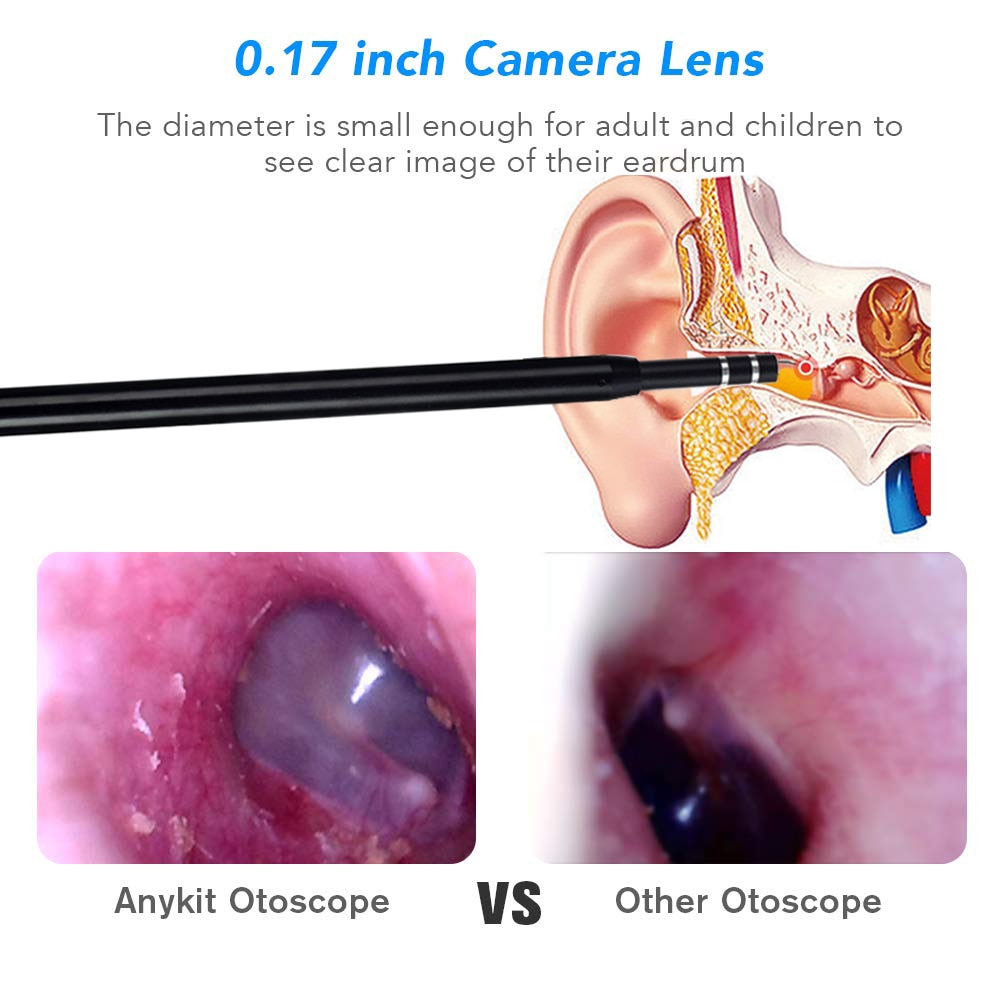 3 in 1 Waterproof Ear Camera Snapitonline