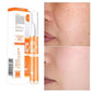 TripleAction BlemishSkin Corrector Serum - Snapitonline
