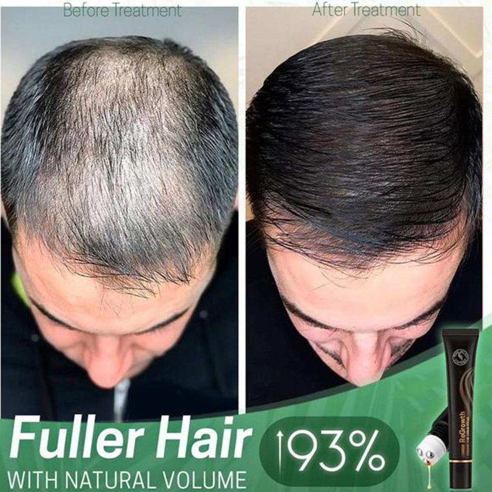 Organic Hair Serum Roller - Snapitonline